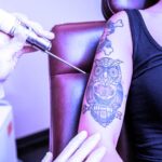 How To Care For Tattoo Removal Tattoo Removal